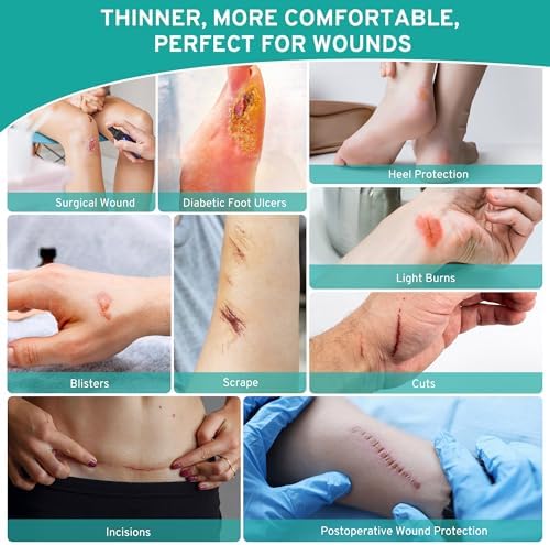 Upadated Hydrocolloid Bandages,2in*5ft Hydrocolloid Roll for Wound Care,Medical-Grade Hydrocolloid Patch Bandages with Self-Adhesive, Flexible & Waterproof DIY Size & Shape (2in*15ft)