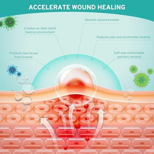 Upadated Hydrocolloid Bandages,2in*5ft Hydrocolloid Roll for Wound Care,Medical-Grade Hydrocolloid Patch Bandages with Self-Adhesive, Flexible & Waterproof DIY Size & Shape (2in*15ft)