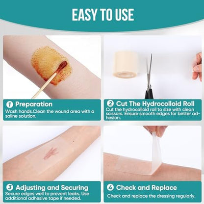 Hydrocolloid Roll for Wound Care, Hydrocolloid Patch Bandages with Self-Adhesive, Bed Sore Bandages, Highly Absorbent for Burn, Blister, Acne Care, Sterile and Waterproof (2in x 12ft)
