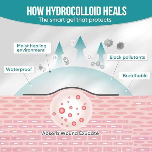 Hydrocolloid Roll for Wound Care, Hydrocolloid Patch Bandages with Self-Adhesive, Bed Sore Bandages, Highly Absorbent for Burn, Blister, Acne Care, Sterile and Waterproof (2in x 12ft)