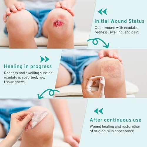 Upadated Hydrocolloid Bandages,2in*5ft Hydrocolloid Roll for Wound Care,Medical-Grade Hydrocolloid Patch Bandages with Self-Adhesive, Flexible & Waterproof DIY Size & Shape (2in*15ft)