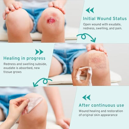 Upadated Hydrocolloid Bandages,2in*5ft Hydrocolloid Roll for Wound Care,Medical-Grade Hydrocolloid Patch Bandages with Self-Adhesive, Flexible & Waterproof DIY Size & Shape (2in*15ft)