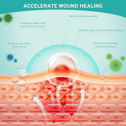 Upadated Hydrocolloid Bandages,2in*5ft Hydrocolloid Roll for Wound Care,Medical-Grade Hydrocolloid Patch Bandages with Self-Adhesive, Flexible & Waterproof DIY Size & Shape (2in*15ft)