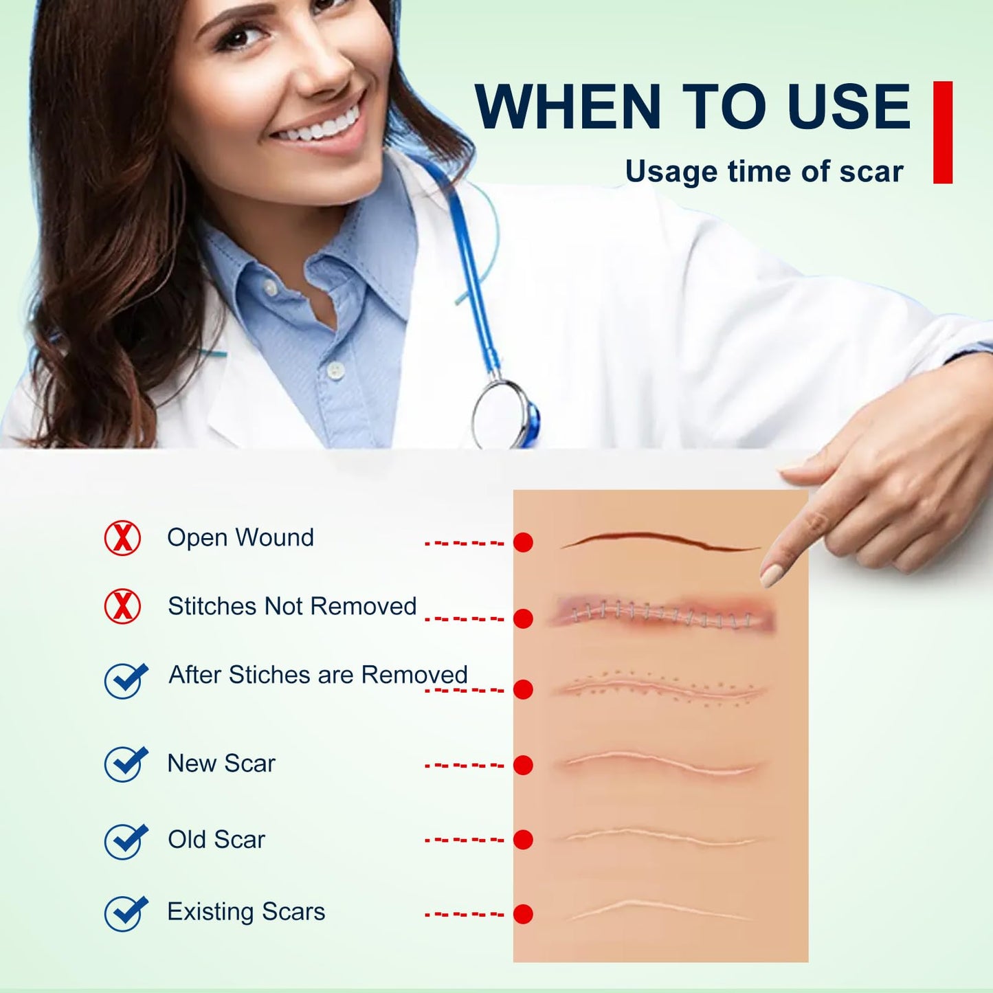 Silicone Scar Sheets (1.6” x 120” Roll-3M), Silicone Scar Tape Roll, Scar Silicone Strips, Reusable, Professional Scar Removal Sheets for C-Section, Surgery, Burn, Keloid, Acne et