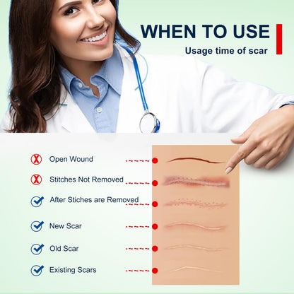 Silicone Scar Sheets (1.6” x 120” Roll-3M), Silicone Scar Tape Roll, Scar Silicone Strips, Reusable, Professional Scar Removal Sheets for C-Section, Surgery, Burn, Keloid, Acne et